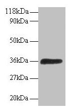 Western blot All lanes: ATP6V1E1 antibody at 2microg/ml + 293T whole cell lysate Secondary Goat polyclonal to rabbit IgG at 1/15000 dilution Predicted band size: 27, 24, 23 kDa Observed band size: 36 kDa Western blot All lanes: ATP6V1E1 antibody at 2microg/ml + 293T whole cell lysate Secondary Goat polyclonal to rabbit IgG at 1/15000 dilution Predicted band size: 27, 24, 23 kDa Observed band size: 36 kDa