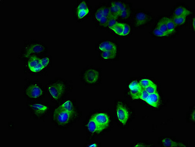 Immunofluorescent analysis of MCF-7 cells using CSB-PA022979LA01HU at dilution of 1:100 and Alexa Fluor 488-congugated AffiniPure Goat Anti-Rabbit IgG(H+L)