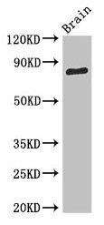 Western Blot Positive WB detected in: Mouse brain tissue All lanes: SV2B antibody at 3.4microg/ml Secondary Goat polyclonal to rabbit IgG at 1/50000 dilution Predicted band size: 78, 61 kDa Observed band size: 78 kDa Western Blot Positive WB detected in: Mouse brain tissue All lanes: SV2B antibody at 3.4microg/ml Secondary Goat polyclonal to rabbit IgG at 1/50000 dilution Predicted band size: 78, 61 kDa Observed band size: 78 kDa
