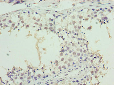 Immunohistochemistry of paraffin-embedded human testis tissue using CSB-PA023018LA01HU at dilution of 1:100