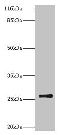 Western blot All lanes: TK1 antibody at 2microg/ml + CEM whole cell lysate Secondary Goat polyclonal to rabbit IgG at 1/10000 dilution Predicted band size: 26 kDa Observed band size: 26 kDa Western blot All lanes: TK1 antibody at 2microg/ml + CEM whole cell lysate Secondary Goat polyclonal to rabbit IgG at 1/10000 dilution Predicted band size: 26 kDa Observed band size: 26 kDa