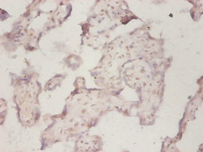 Immunohistochemistry of paraffin-embedded human placenta tissue using CSB-PA02364A0Rb at dilution of 1:50