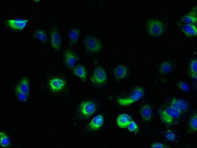Immunofluorescent analysis of MCF-7 cells using CSB-PA023668LA01HU at dilution of 1:100 and Alexa Fluor 488-congugated AffiniPure Goat Anti-Rabbit IgG(H+L) Immunofluorescent analysis of MCF-7 cells using CSB-PA023668LA01HU at dilution of 1:100 and Alexa Fluor 488-congugated AffiniPure Goat Anti-Rabbit IgG(H+L)