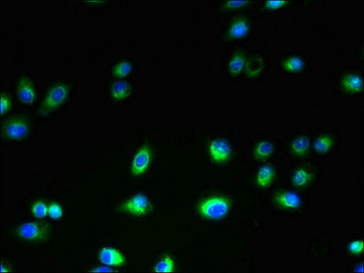 Immunofluorescent analysis of A2780 cells using CSB-PA023673LA01HU at dilution of 1:100 and Alexa Fluor 488-congugated AffiniPure Goat Anti-Rabbit IgG(H+L) Immunofluorescent analysis of A2780 cells using CSB-PA023673LA01HU at dilution of 1:100 and Alexa Fluor 488-congugated AffiniPure Goat Anti-Rabbit IgG(H+L)