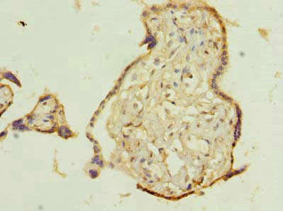 Immunohistochemistry of paraffin-embedded human placenta tissue using CSB-PA023683LA01HU at dilution of 1:100 Immunohistochemistry of paraffin-embedded human placenta tissue using CSB-PA023683LA01HU at dilution of 1:100