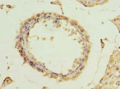 Immunohistochemistry of paraffin-embedded human testis tissue using CSB-PA023683LA01HU at dilution of 1:100