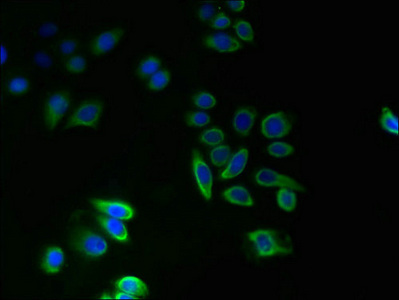 Immunofluorescent analysis of PC-3 cells using CSB-PA023720LA01HU at dilution of 1:100 and Alexa Fluor 488-congugated AffiniPure Goat Anti-Rabbit IgG(H+L)