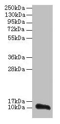 Western blot All lanes: TMEM14A antibody at 0.8microg/ml + PC-3 whole cell lysate Secondary Goat polyclonal to rabbit IgG at 1/10000 dilution Predicted band size: 11 kDa Observed band size: 11 kDa