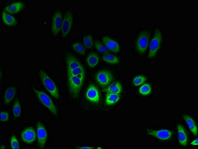 anti-Homo sapiens (Human) TMEM184C Antibody raised in Rabbit - Cusabio anti-Homo sapiens (Human) TMEM184C Antibody raised in Rabbit - Cusabio