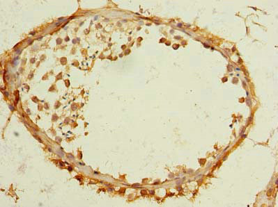 Immunohistochemistry of paraffin-embedded human testis tissue using CSB-PA023774LA01HU at dilution of 1:100 Immunohistochemistry of paraffin-embedded human testis tissue using CSB-PA023774LA01HU at dilution of 1:100