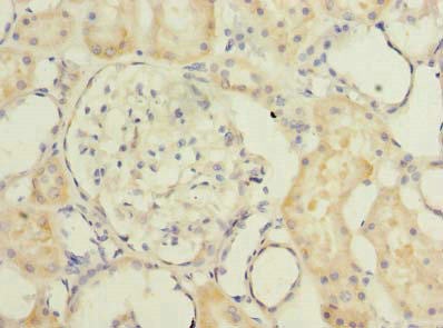 Immunohistochemistry of paraffin-embedded human kidney tissue using CSB-PA023774LA01HU at dilution of 1:100