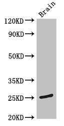 Western Blot Positive WB detected in: Mouse brain tissue All lanes: TMEM186 antibody at 5microg/ml Secondary Goat polyclonal to rabbit IgG at 1/50000 dilution Predicted band size: 25 kDa Observed band size: 25 kDa
