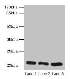 Western blot All lanes: GM2A antibody at 10microg/ml Lane 1: Rat liver tissue Lane 2: Mouse stomach tissue Lane 3: Mouse small intestine tissue Secondary Goat polyclonal to rabbit IgG at 1/10000 dilution Predicted band size: 21 kDa Observed band size: 21 kDa Western blot All lanes: GM2A antibody at 10microg/ml Lane 1: Rat liver tissue Lane 2: Mouse stomach tissue Lane 3: Mouse small intestine tissue Secondary Goat polyclonal to rabbit IgG at 1/10000 dilution Predicted band size: 21 kDa Observed band size: 21 kDa