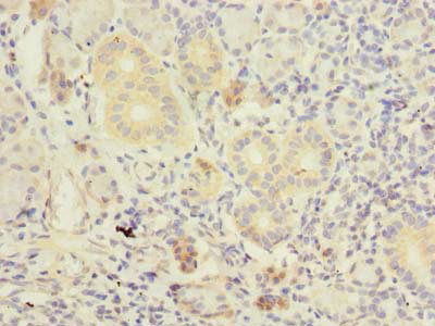Immunohistochemistry of paraffin-embedded human pancreatic tissue using CSB-PA023837LA01HU at dilution of 1:100
