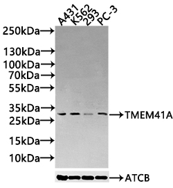 Western blot All lanes: TMEM41A antibody at 0.5microg/ml + Mouse liver tissue Secondary Goat polyclonal to rabbit IgG at 1/10000 dilution Predicted band size: 30 kDa Observed band size: 30 kDa Western blot All lanes: TMEM41A antibody at 0.5microg/ml + Mouse liver tissue Secondary Goat polyclonal to rabbit IgG at 1/10000 dilution Predicted band size: 30 kDa Observed band size: 30 kDa