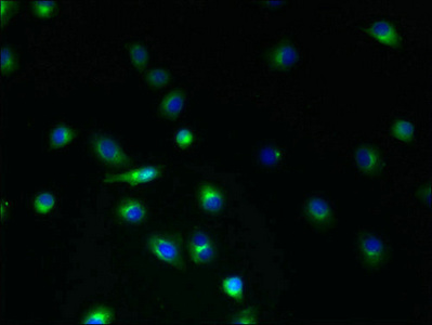 Immunofluorescent analysis of A2780 cells using CSB-PA023842LA01HU at dilution of 1:100 and Alexa Fluor 488-congugated AffiniPure Goat Anti-Rabbit IgG(H+L)