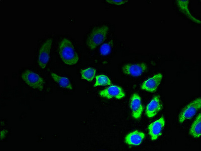Immunofluorescent analysis of A549 cells using CSB-PA023853LA01HU at dilution of 1:100 and Alexa Fluor 488-congugated AffiniPure Goat Anti-Rabbit IgG(H+L)