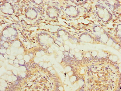 Immunohistochemistry of paraffin-embedded human small intestine tissue using CSB-PA023855LA01HU at dilution of 1:100