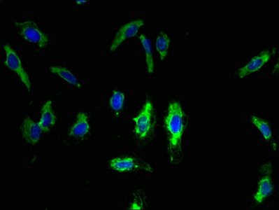 Immunofluorescent analysis of Hela cells using CSB-PA023872LA01HU at dilution of 1:100 and Alexa Fluor 488-congugated AffiniPure Goat Anti-Rabbit IgG(H+L) Immunofluorescent analysis of Hela cells using CSB-PA023872LA01HU at dilution of 1:100 and Alexa Fluor 488-congugated AffiniPure Goat Anti-Rabbit IgG(H+L)