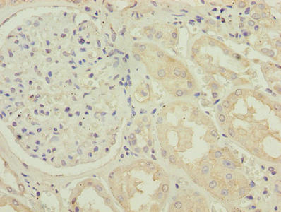 Immunohistochemistry of paraffin-embedded human kidney tissue using CSB-PA023908LA01HU at dilution of 1:100