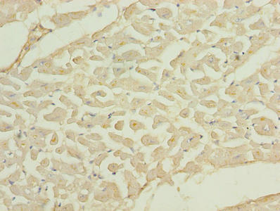 Immunohistochemistry of paraffin-embedded human heart tissue using CSB-PA023908LA01HU at dilution of 1:100