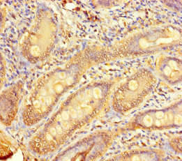 Immunohistochemistry of paraffin-embedded human small intestine tissue using CSB-PA023918LA01HU at dilution of 1:100 Immunohistochemistry of paraffin-embedded human small intestine tissue using CSB-PA023918LA01HU at dilution of 1:100