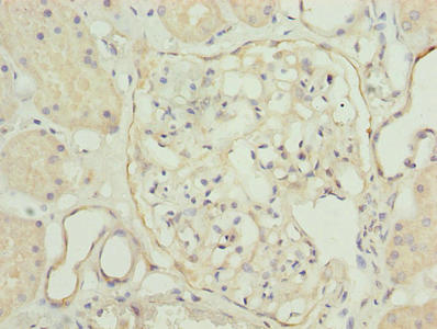 Immunohistochemistry of paraffin-embedded human kidney tissue using CSB-PA024116LA01HU at dilution of 1:100