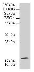 Western blot All lanes: TPPP2 antibody at 8microg/ml + HepG2 whole cell lysate Secondary Goat polyclonal to rabbit IgG at 1/10000 dilution Predicted band size: 19 kDa Observed band size: 19 kDa Western blot All lanes: TPPP2 antibody at 8microg/ml + HepG2 whole cell lysate Secondary Goat polyclonal to rabbit IgG at 1/10000 dilution Predicted band size: 19 kDa Observed band size: 19 kDa