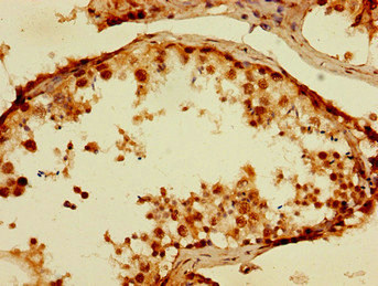 Immunohistochemistry of paraffin-embedded human testis tissue using CSB-PA024128LA01HU at dilution of 1:100 Immunohistochemistry of paraffin-embedded human testis tissue using CSB-PA024128LA01HU at dilution of 1:100