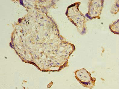 Immunohistochemistry of paraffin-embedded human placenta tissue using CSB-PA024229LA01HU at dilution of 1:100 Immunohistochemistry of paraffin-embedded human placenta tissue using CSB-PA024229LA01HU at dilution of 1:100