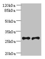 Western Blotting(WB) - Trem2 Antibody