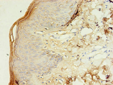 Immunohistochemistry of paraffin-embedded human skin tissue using CSB-PA025164LA01HU at dilution of 1:100