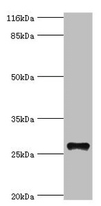 Western blot All lanes: TSPAN6 antibody at 20microg/ml + Mouse liver tissue Secondary Goat polyclonal to rabbit IgG at 1/10000 dilution Predicted band size: 28 kDa Observed band size: 28 kDa Western blot All lanes: TSPAN6 antibody at 20microg/ml + Mouse liver tissue Secondary Goat polyclonal to rabbit IgG at 1/10000 dilution Predicted band size: 28 kDa Observed band size: 28 kDa