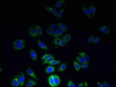 Immunofluorescent analysis of HepG2 cells using CSB-PA025165LA01HU at dilution of 1:100 and Alexa Fluor 488-congugated AffiniPure Goat Anti-Rabbit IgG(H+L) Immunofluorescent analysis of HepG2 cells using CSB-PA025165LA01HU at dilution of 1:100 and Alexa Fluor 488-congugated AffiniPure Goat Anti-Rabbit IgG(H+L)