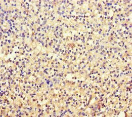 Immunohistochemistry of paraffin-embedded human spleen tissue using CSB-PA025165LA01HU at dilution of 1:100