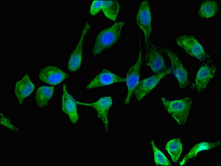 Immunofluorescent analysis of Hela cells using CSB-PA025166LA01HU at dilution of 1:100 and Alexa Fluor 488-congugated AffiniPure Goat Anti-Rabbit IgG(H+L)