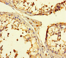 CSB-PA025348LA01HU