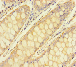 CSB-PA025348LA01HU