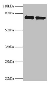 Western blot All lanes: RPS10 antibody at 2microg/ml Lane 1: EC109 whole cell lysate Lane 2: 293T whole cell lysate Secondary Goat polyclonal to rabbit IgG at 1/15000 dilution Predicted band size: 19 kDa Observed band size: 80 kDa Western blot All lanes: RPS10 antibody at 2microg/ml Lane 1: EC109 whole cell lysate Lane 2: 293T whole cell lysate Secondary Goat polyclonal to rabbit IgG at 1/15000 dilution Predicted band size: 19 kDa Observed band size: 80 kDa