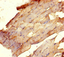 Immunohistochemistry of paraffin-embedded human skeletal muscle tissue using CSB-PA025681HA01HU at dilution of 1:100