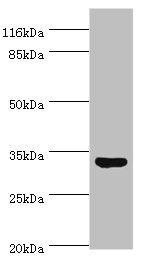 Western blot All lanes: USF1 antibody at 2microg/ml + HepG2 whole cell lysate Secondary Goat polyclonal to rabbit IgG at 1/10000 dilution Predicted band size: 34, 28 kDa Observed band size: 34 kDa Western blot All lanes: USF1 antibody at 2microg/ml + HepG2 whole cell lysate Secondary Goat polyclonal to rabbit IgG at 1/10000 dilution Predicted band size: 34, 28 kDa Observed band size: 34 kDa
