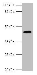 Western blot All lanes: USP12 antibody at 2microg/ml + Mouse liver tissue Secondary Goat polyclonal to rabbit IgG at 1/10000 dilution Predicted band size: 43 kDa Observed band size: 43 kDa Western blot All lanes: USP12 antibody at 2microg/ml + Mouse liver tissue Secondary Goat polyclonal to rabbit IgG at 1/10000 dilution Predicted band size: 43 kDa Observed band size: 43 kDa