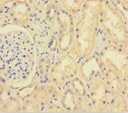 Immunohistochemistry of paraffin-embedded human kidney tissue using CSB-PA026193LA01HU at dilution of 1:100
