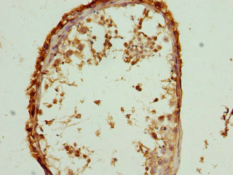 Immunohistochemistry of paraffin-embedded human testis tissue using CSB-PA02625A0Rb at dilution of 1:100 Immunohistochemistry of paraffin-embedded human testis tissue using CSB-PA02625A0Rb at dilution of 1:100