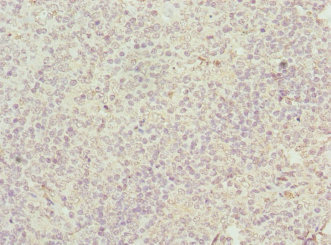 Immunohistochemistry of paraffin-embedded human tonsil tissue using CSB-PA02625A0Rb at dilution of 1:100