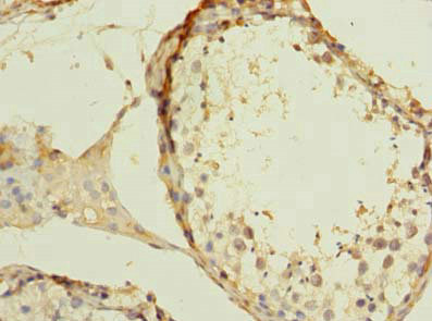 Immunohistochemistry of paraffin-embedded human testis tissue using CSB-PA026335LA01HU at dilution of 1:100 Immunohistochemistry of paraffin-embedded human testis tissue using CSB-PA026335LA01HU at dilution of 1:100