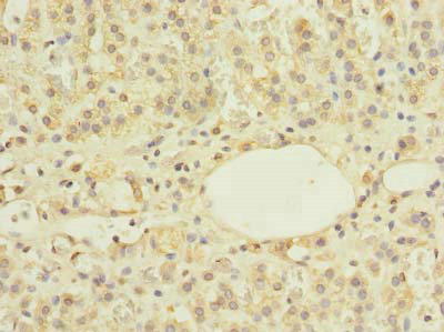 Immunohistochemistry of paraffin-embedded human adrenal gland tissue using CSB-PA026335LA01HU at dilution of 1:100
