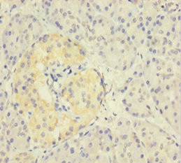Immunohistochemistry of paraffin-embedded human pancreatic tissue using CSB-PA026523LA01HU at dilution of 1:100 Immunohistochemistry of paraffin-embedded human pancreatic tissue using CSB-PA026523LA01HU at dilution of 1:100