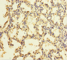 Immunohistochemistry of paraffin-embedded human lung tissue using CSB-PA026523LA01HU at dilution of 1:100