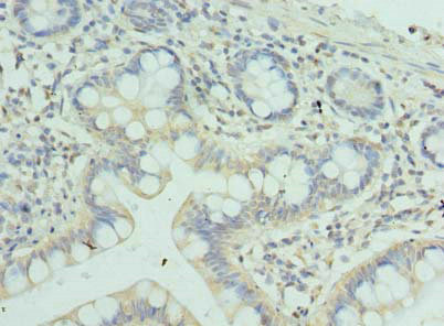 Immunohistochemistry of paraffin-embedded human small intestine tissue using CSB-PA026569LA01HU at dilution of 1:100